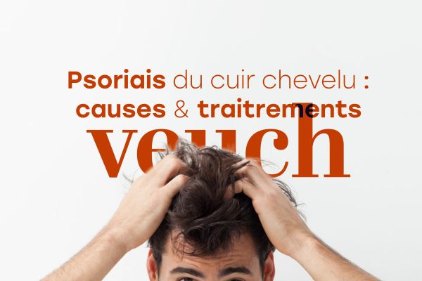 psoriasis causes et traitements