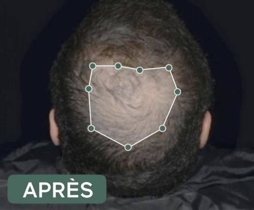 résultats produits veuch