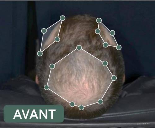 résultats produits veuch