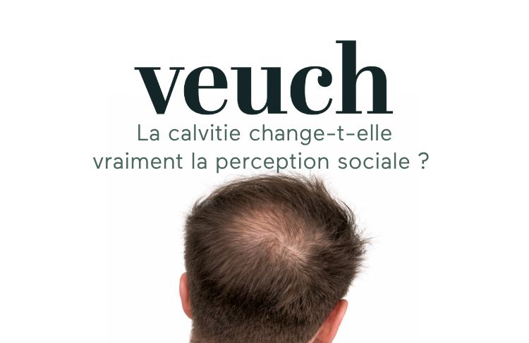 La calvitie change-t-elle vraiment la perception sociale ?