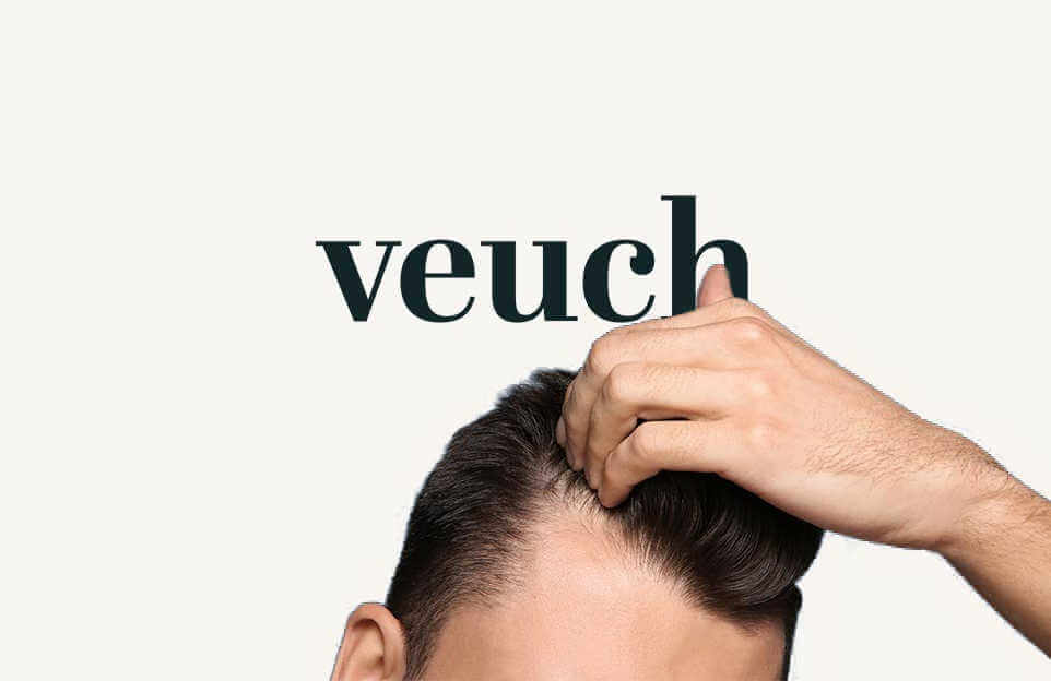 perte cheveux chez l'homme