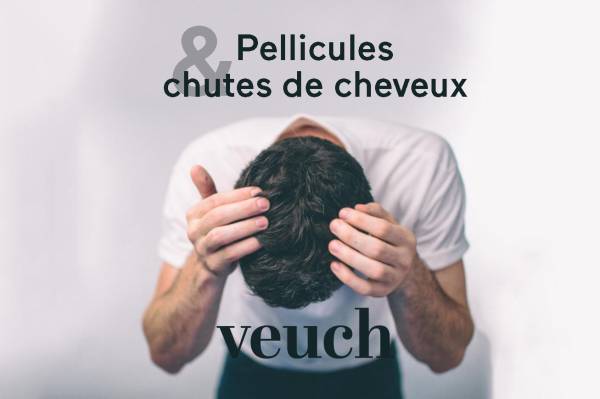 pellicule calvitie lien