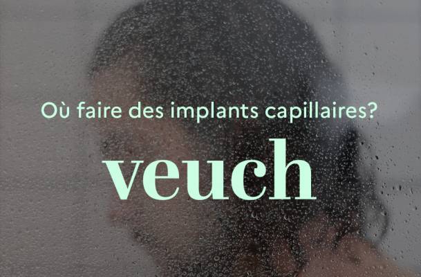 implants ou les faire