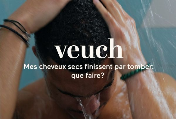 cheveux cassants que faire