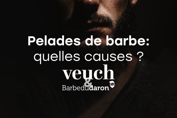 pelades de barbe causes et solutions