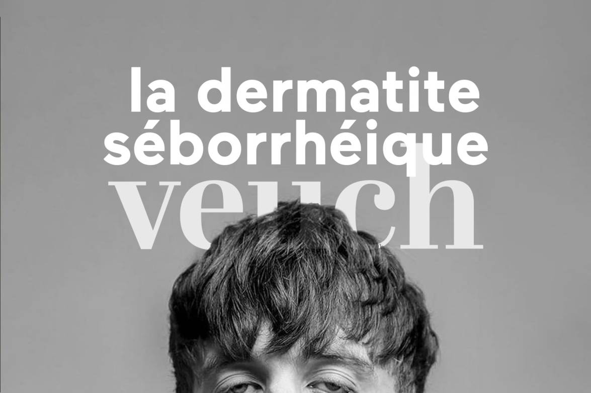 dermite séborrhéique causes traitements