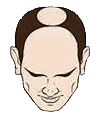 Echelle de Norwood