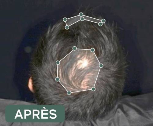 résultats produits veuch