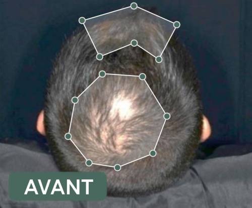 résultats produits veuch