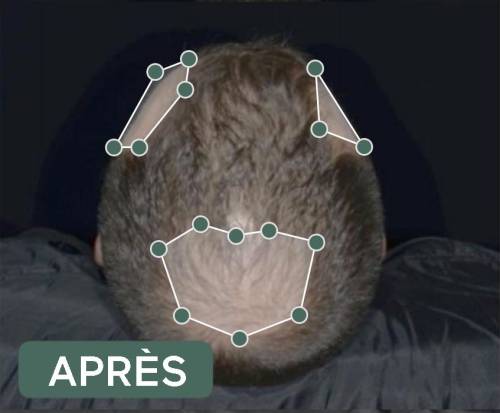 résultats produits veuch