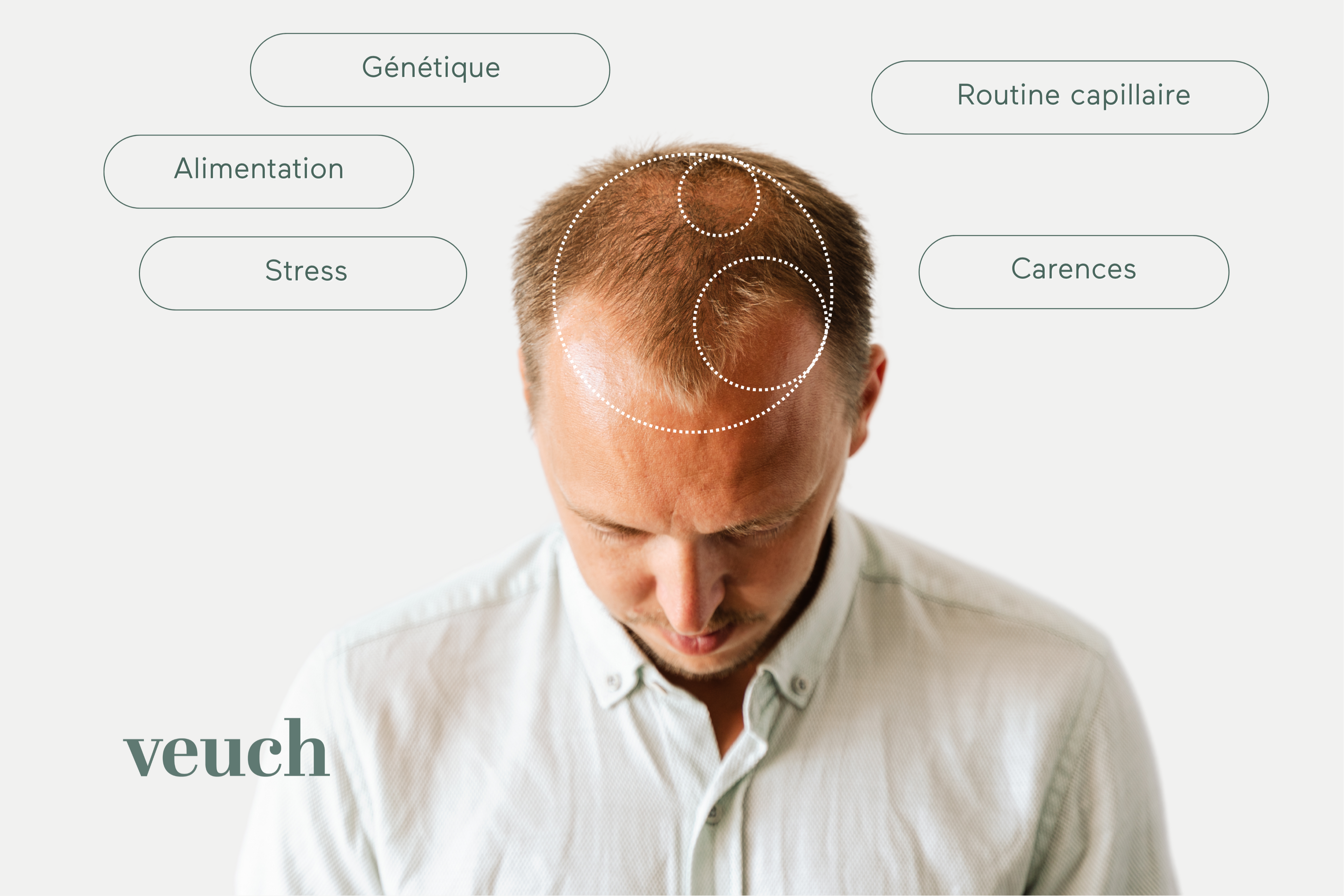 Diagnostic capillaire Hairscan