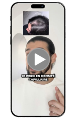 avant la cure mike